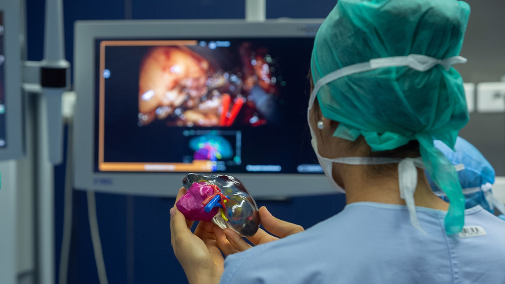 Un hôpital Français améliore la chirurgie du cancer du rein grâce à la seule technologie d'impression 3d multi-matériaux et multi-couleurs au monde
